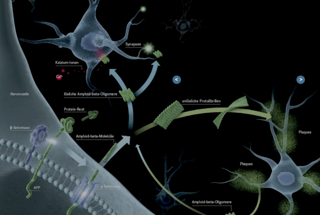 Die Bildung und Aggregation des Amyloid-beta-Proteins ist ein komplexer Prozess. Copyright: Tricklabor