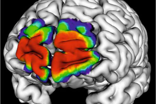 Der dreidimensionale zelluläre JuBrain-Atlas basiert auf mikrostrukturellen Kartierungen von zehn post mortem Gehirnen. Die Karten zeigen die Wahrscheinlichkeitsverteilungen als Maß für die interindividuelle Variabilität der anatomischen Areale im Hinblick auf Raum und Ausdehnung. Copyright: Forschungszentrum Jülich/HBP