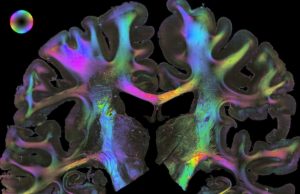 Eine zentrale Bedeutung kommt den Verbindungen zwischen Hirnarealen zu. Um diese sichtbar zu machen, durchleuchten die Forscher Gewebeschnitte mit polarisiertem Licht. Polarized Light imaging - kurz "3D-PLi" - zeigt mikroskopisch genau Nervenfaserbahnen und erlaubt es, ihren Verlauf durch das Gehirn zu analysieren. Entsprechend ihrer Raumrichtung lassen sich die Fasern in verschiedenen Farben anzeigen. Copyright: Forschungszentrum Jülich / Markus Axer