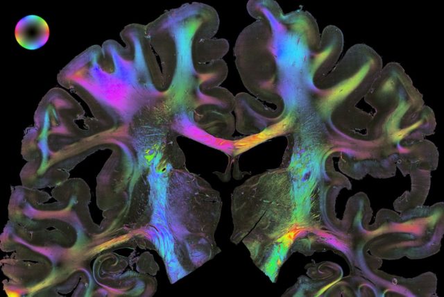 Eine zentrale Bedeutung kommt den Verbindungen zwischen Hirnarealen zu. Um diese sichtbar zu machen, durchleuchten die Forscher Gewebeschnitte mit polarisiertem Licht. Polarized Light imaging - kurz 