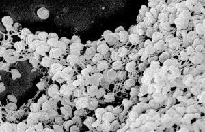 Elektronenmikroskopische Aufnahme eines Zell-Aggregats von Comammox-Bakterien der Art Nitrospira inopinata. Die Zellen haben einen Durchmesser von etwa 0,3 Mikrometer und sind bis zu 1,7 Mikrometer lang. Foto: Anne Daebeler und Stefano Romano, Universität Wien
