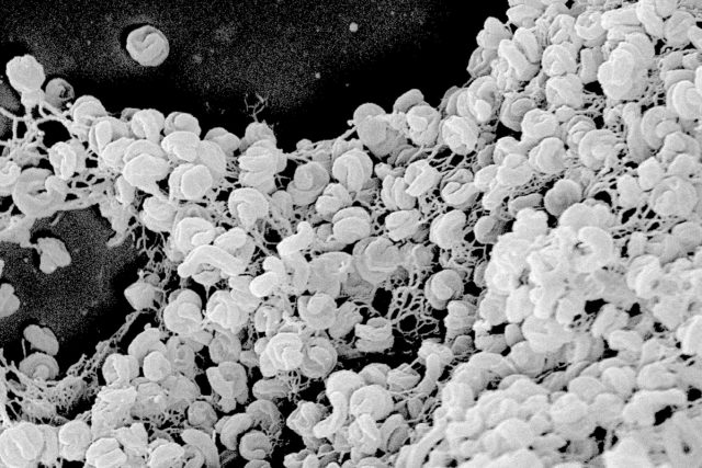 Elektronenmikroskopische Aufnahme eines Zell-Aggregats von Comammox-Bakterien der Art Nitrospira inopinata. Die Zellen haben einen Durchmesser von etwa 0,3 Mikrometer und sind bis zu 1,7 Mikrometer lang. Foto: Anne Daebeler und Stefano Romano, Universität Wien
